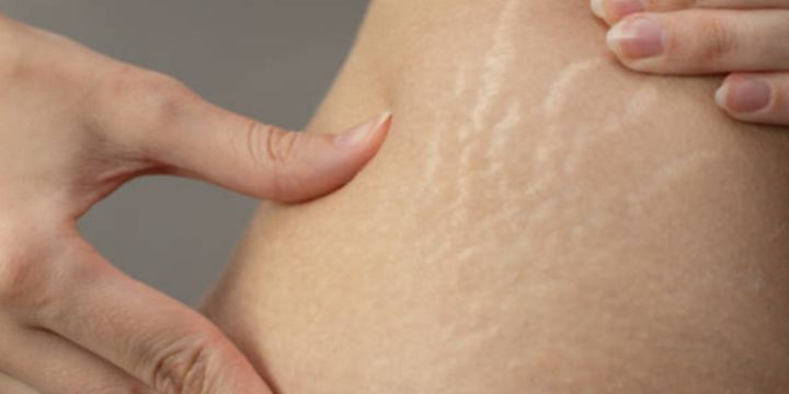 La vitamina E también refuerza la barrera cutánea que es la capa más externa de la dermis y se compone de células, lípidos, aminoácidos y ácidos grasos. UNSPLASH/Dmitry Epov